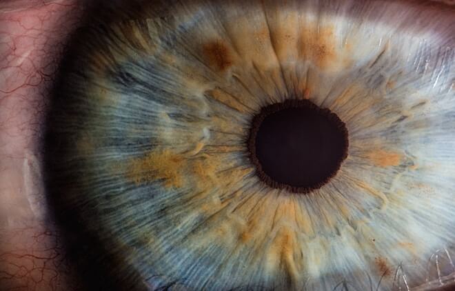 A close-up of an eye